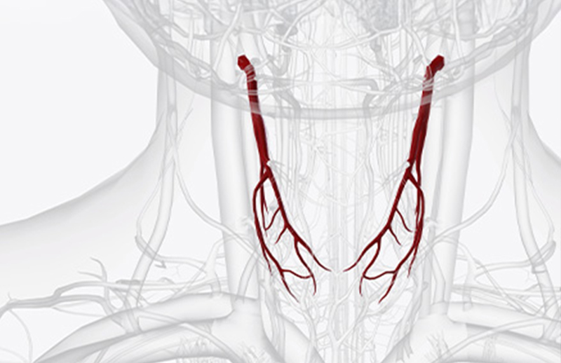 Karotis Darlığında Pıhtı Önleyici Sistemle Stentleme