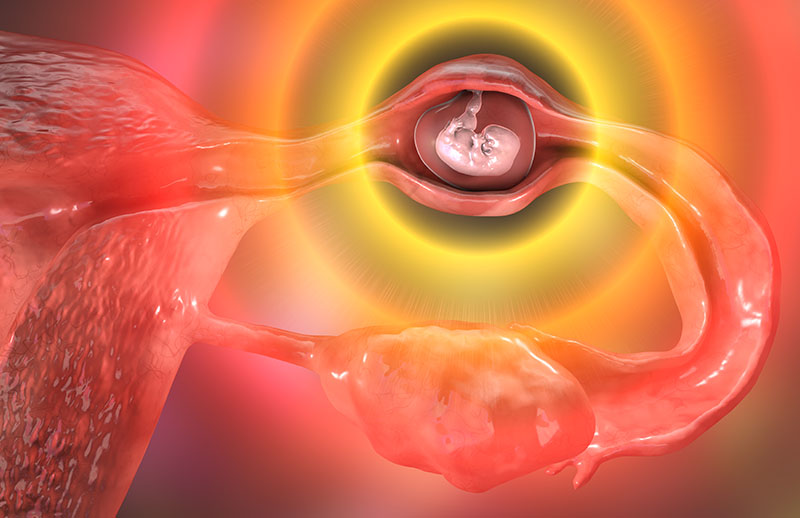 Laparoskopik (Kapalı) Ektopik Gebelik