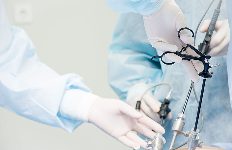 Laparoskopik (Kapalı) Myomektomi