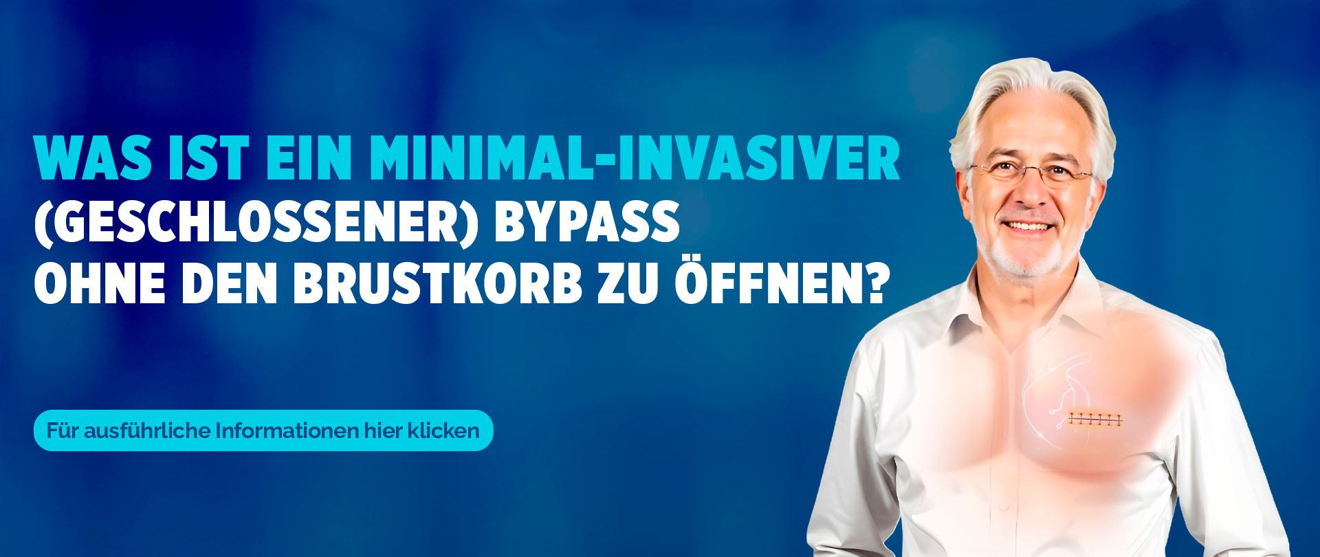 Göğüs Kafesi Açılmadan Minimal Bypass DE